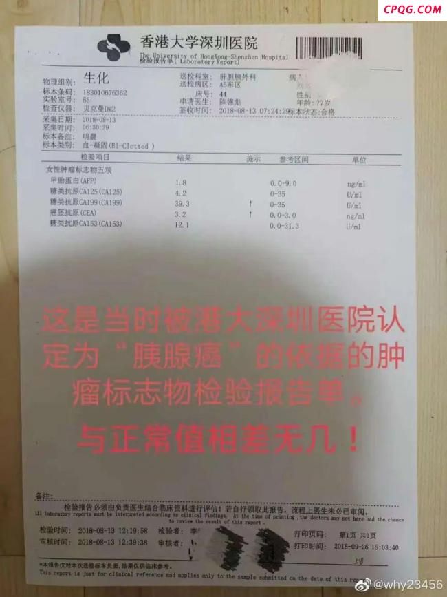 7旬老人没有肿瘤被切除5个器官 家属报警追究刑责