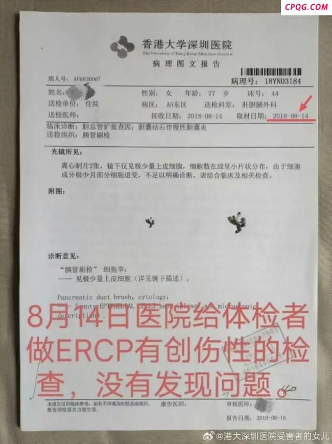 7旬老人没有肿瘤被切除5个器官 家属报警追究刑责