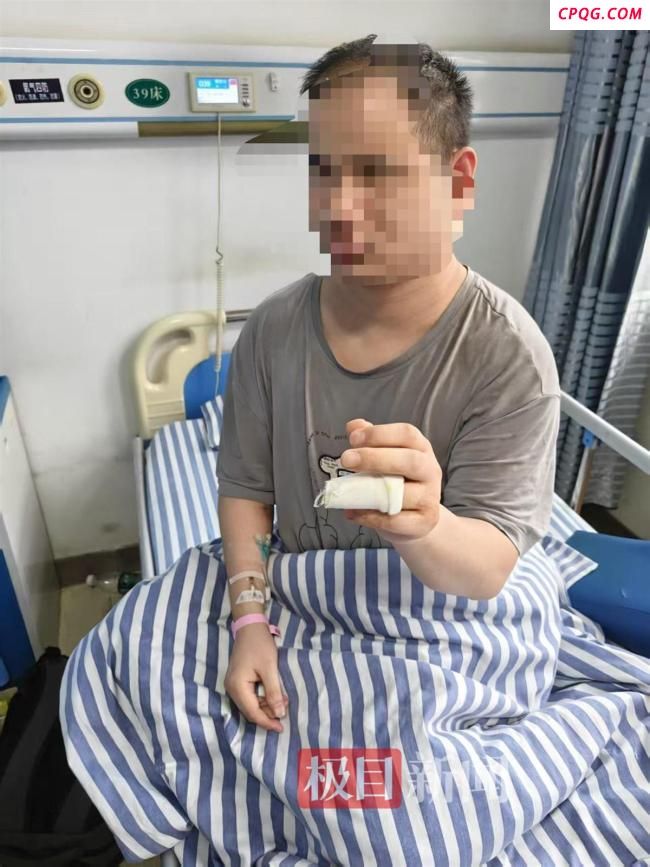 盲人体验小米汽车致手指骨折