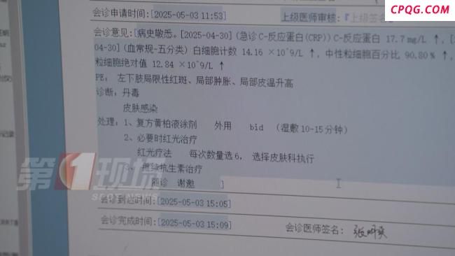 男子湿鞋不换致高烧不退感染丹毒 雨水泡脚隐患多
