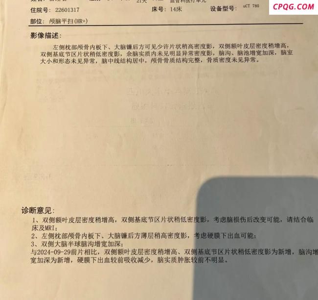 5个月女婴心脏手术后出现脑损伤 家属质疑治疗过程