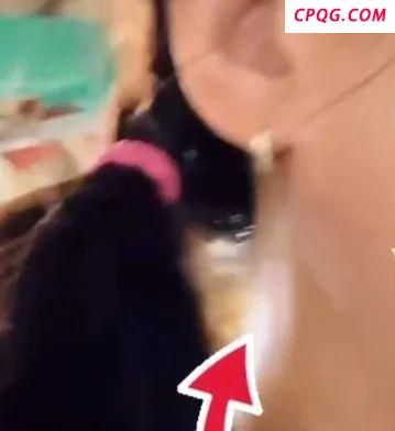 陈意涵医美后脸歪了