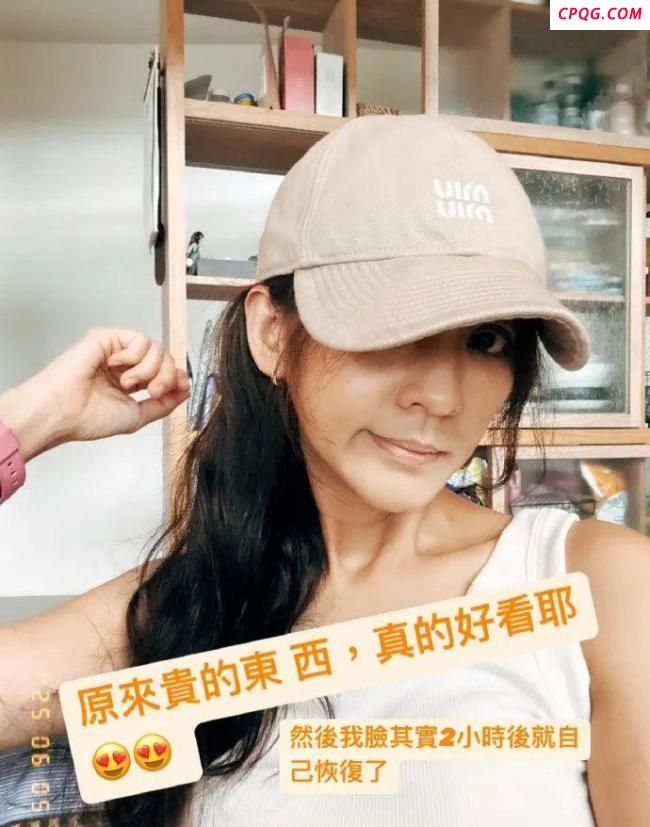 陈意涵医美后脸歪了 脸部肿胀引发网友关注