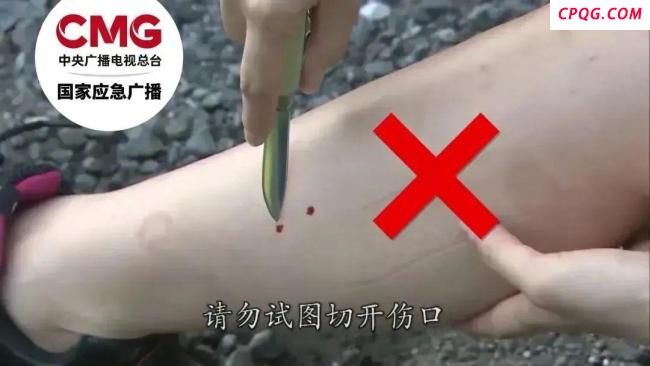 游客被咬伤身亡相关医生已被停职 调查组正加紧处理
