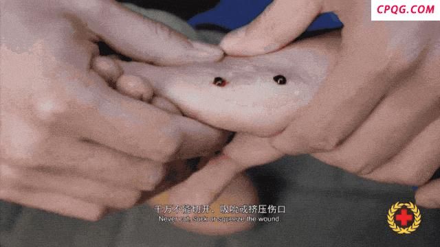 游客被咬伤身亡相关医生已被停职 调查组正加紧处理