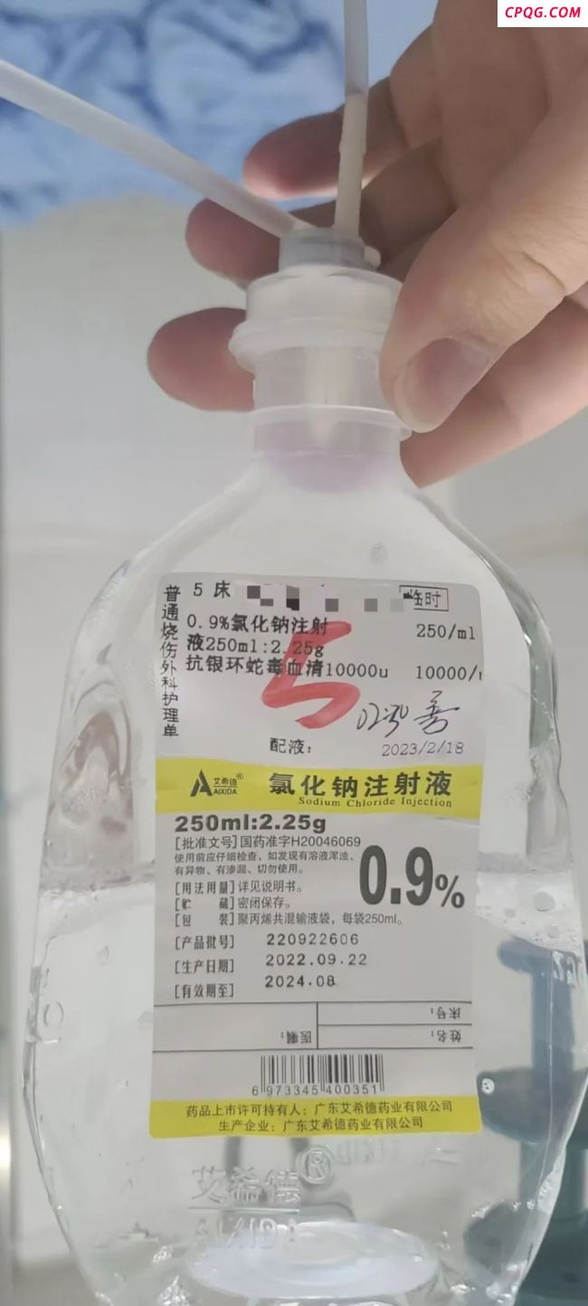女子简述在酒店被毒蛇咬伤 后遗症持续两年