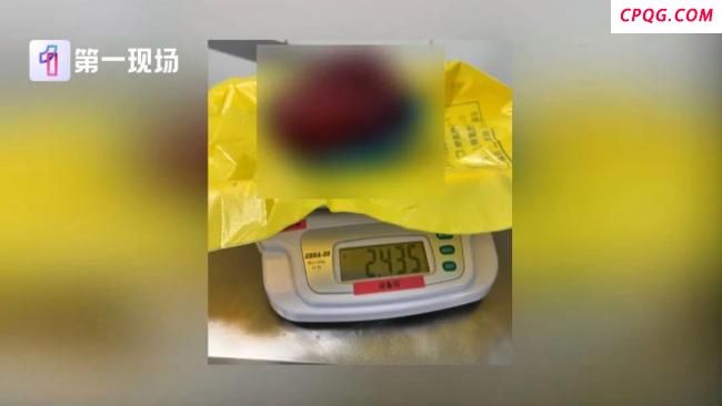 女孩试裤子经提醒后确诊癌症 店员提醒成救命关键