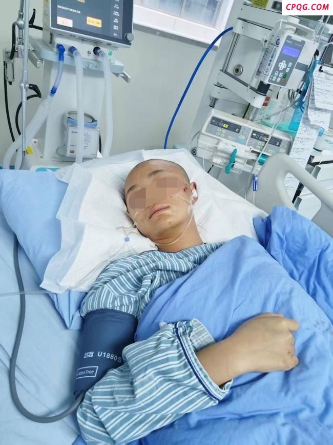 高考前一天艺考生被撞病危 家属发声 女儿已度过危险期