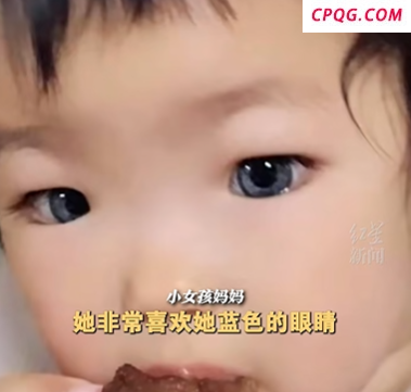 8岁女孩患罕见病眼珠变蓝色