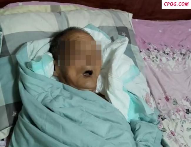 老人被毒蛇咬伤后病情恶化 家属艰难抉择放弃治疗