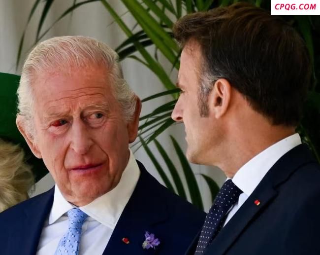 英国国王会见马克龙时“眼角充血”引关注