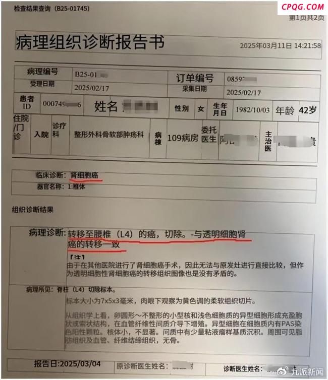 媒体评女子体检10年未出癌症预警 误检漏检引争议