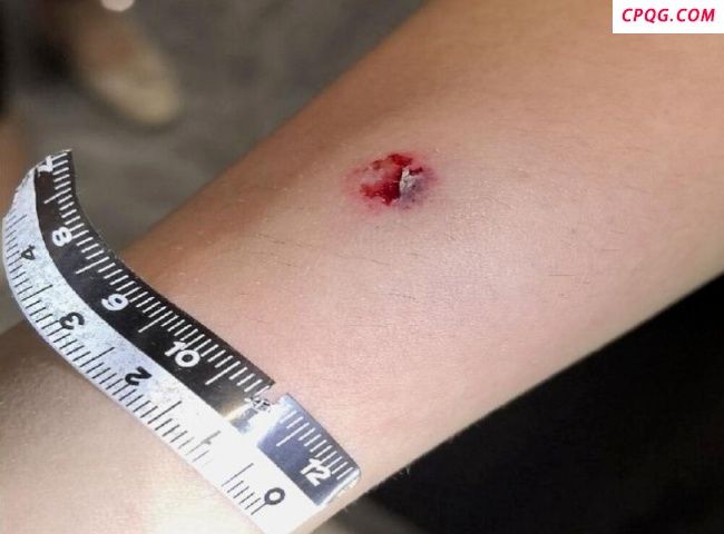 货车司机向路人射钢珠被拘