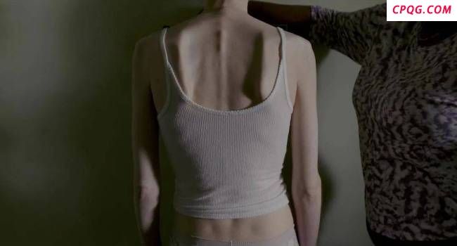 女明星都躲不过的病 盯上了这群女孩 进食障碍的隐秘折磨